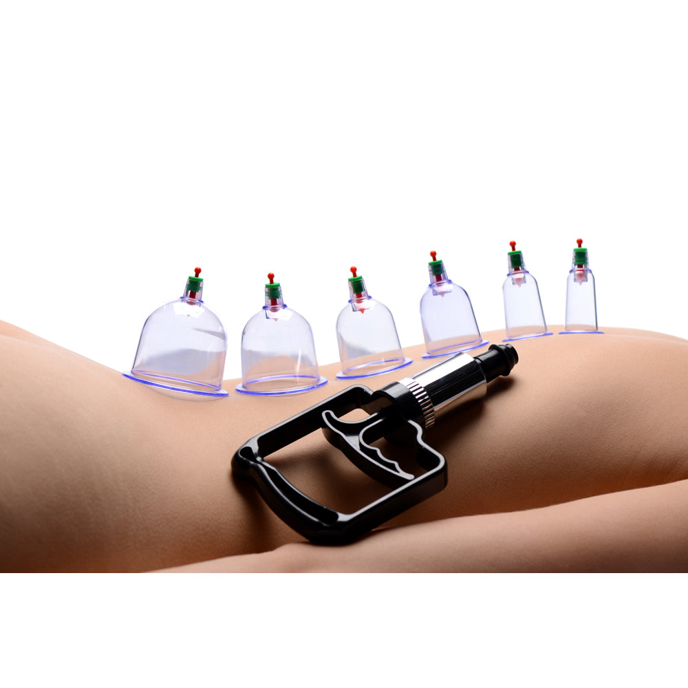 Master Series Sukshen 6 Piece Cupping Set